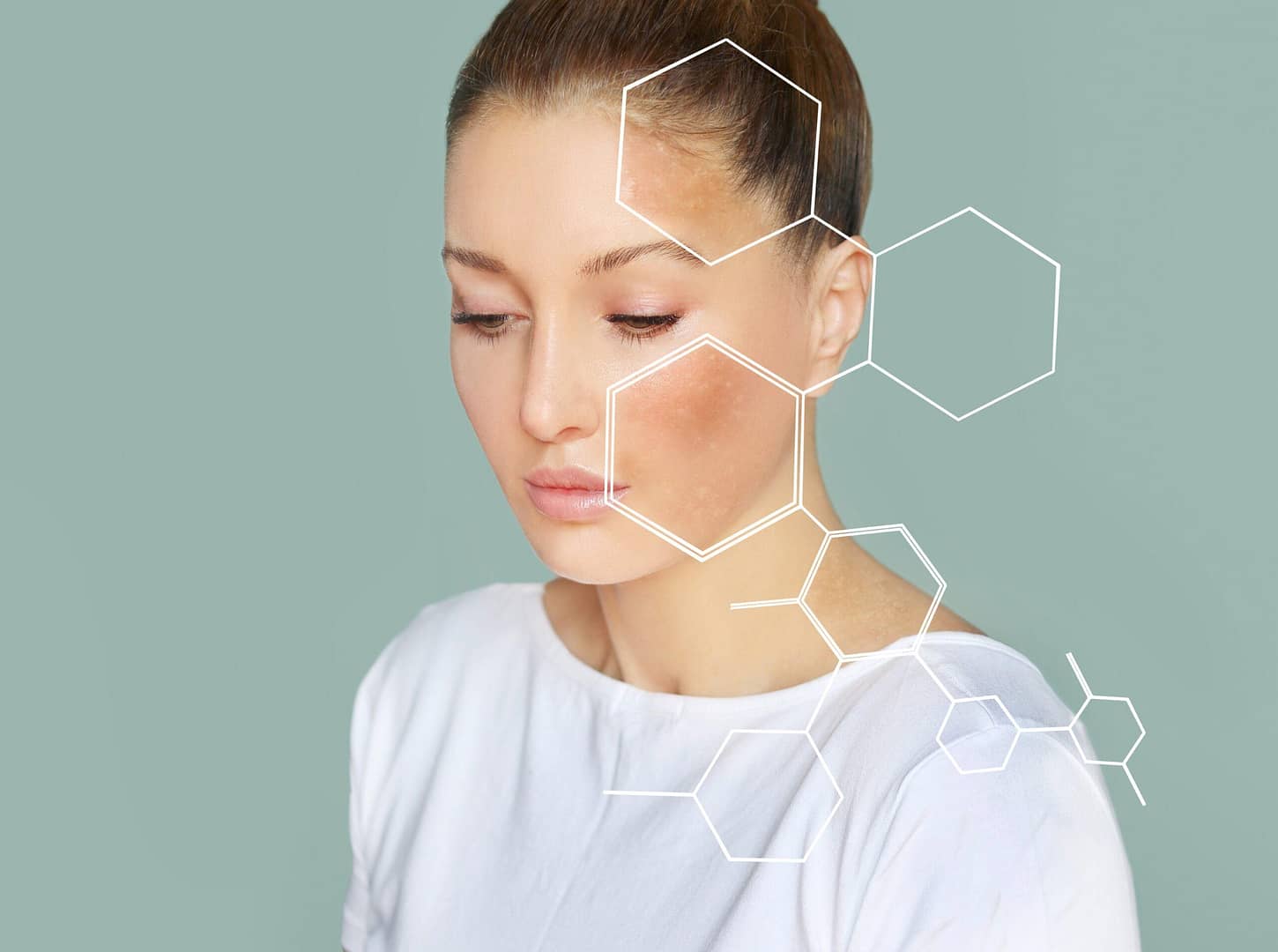 Understanding Pigmentation — And How We Can Gently Fade It